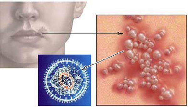 Болит ли горло при коронавирусе?