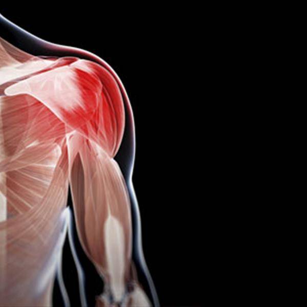 Причины заболевания мышц. Воспаление скелетных мышц. Воспаление мышечной ткани. Миозит плечевого сустава.