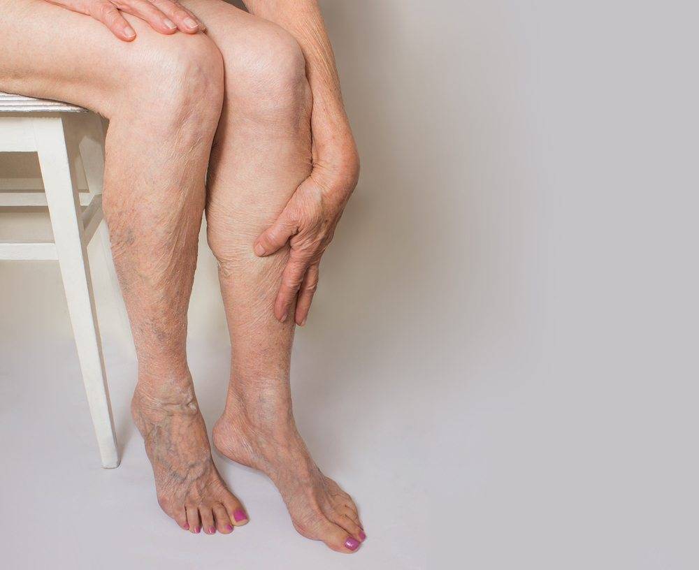 Тяжесть в ногах: основные причины и методы лечения