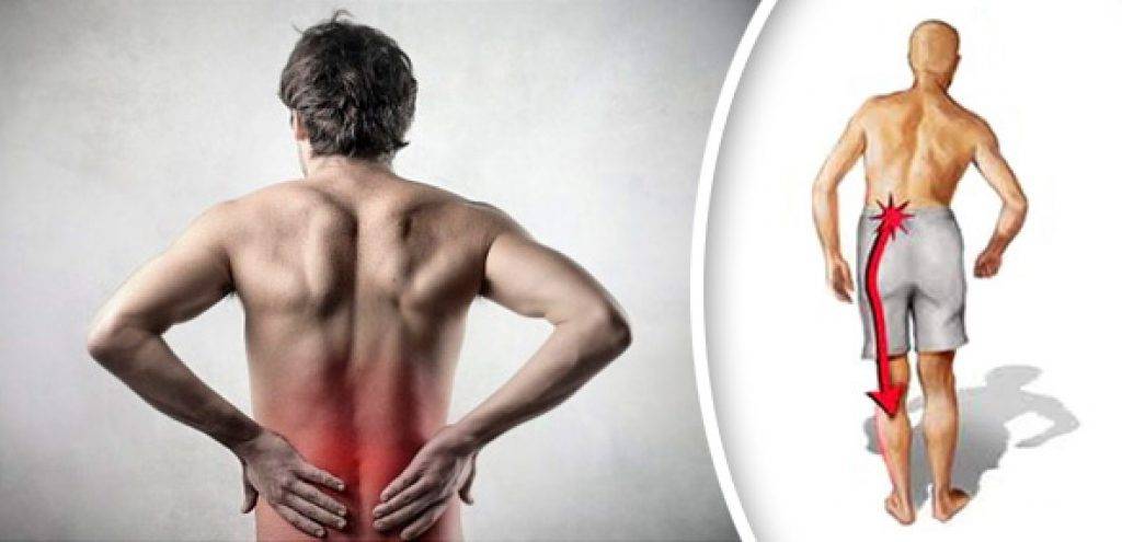 Боли в спине в области поясницы причины лечение и отдает в ногу чем лечить