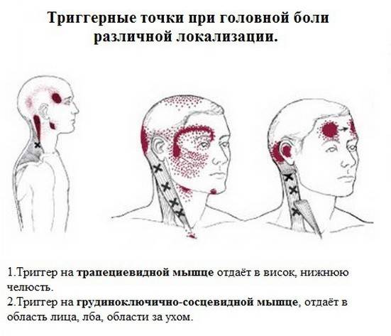 Причины боли в основании черепа и шеи