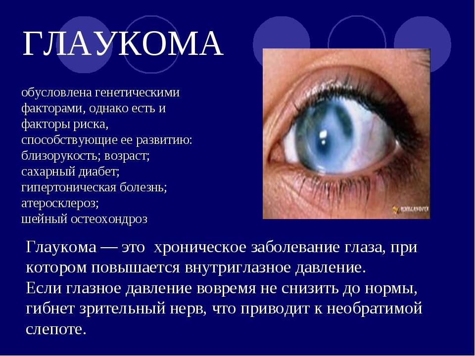 Глаукома: эффективное лечение глаукомы народными средствами, рекомендации от специалистов
