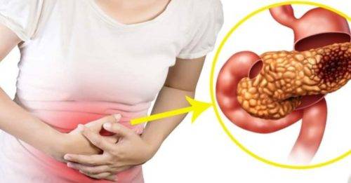Факторы развития липоматоза поджелудочной железы и лечение народными средствами
