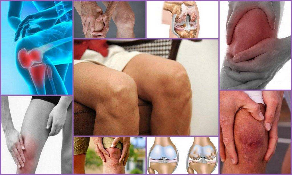 Лечение гонартроза коленного сустава по бубновскому видео