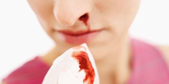 Кровь из носа у ребенка: причины, почему у детей идет кровь из носа утром, днем и ночью / mama66.ru