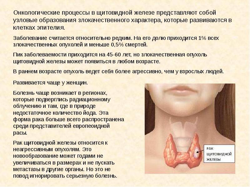 Симптомы заболевания щитовидной железы у женщин, фото | pro shchitovidku