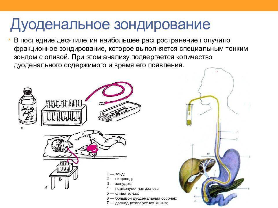 Тонкий желудочный зонд рисунок