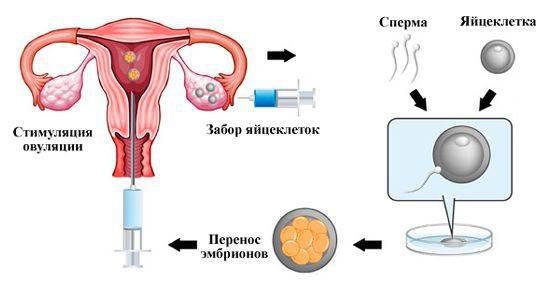 Овариальный резерв яичников: как определить, как повысить, норма и анализы.