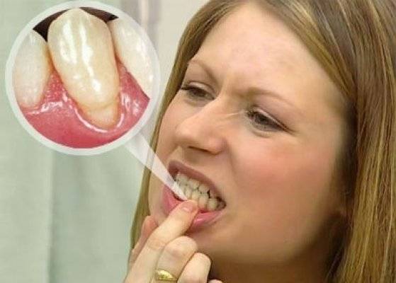 О чем говорит привкус металла во рту: является ли это симптомом заболевания
