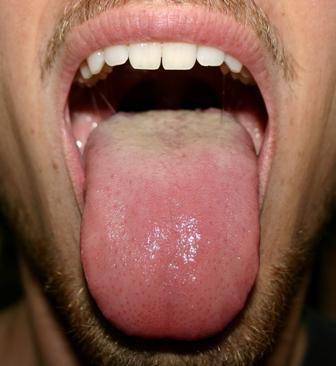 Изучили язык: covid способен вызывать поражения полости рта | статьи | известия