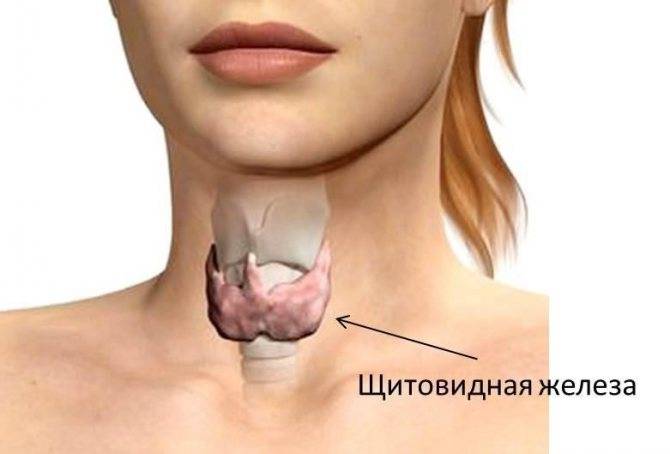 Нарушение работы щитовидной железы у женщин