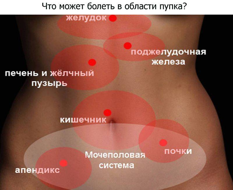 Боль в животе выше пупка: причины, что находится в центре, что болит у мужчин