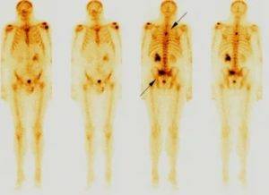 Как проходит сканирование костей скелета?