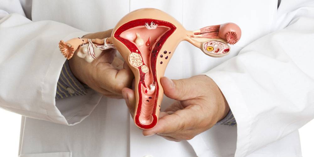 Эндометриоз матки при климаксе: симптомы и лечение у женщин после 50 лет