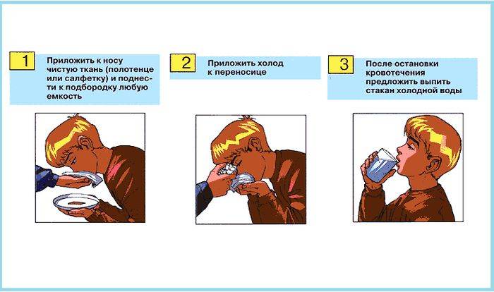 Как остановить кровь из носа: первая помощь если кровь идет без остановки, как правильно остановить