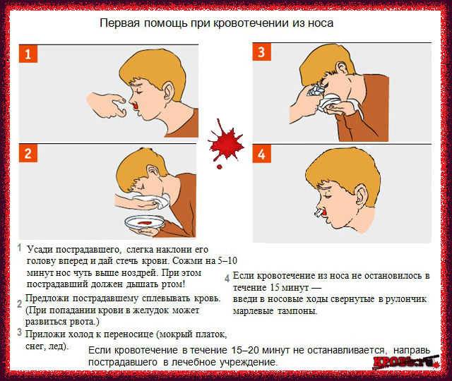 Кровоостанавливающие препараты при носовом кровотечении: средство для остановки крови из носа, таблетки в домашних условиях