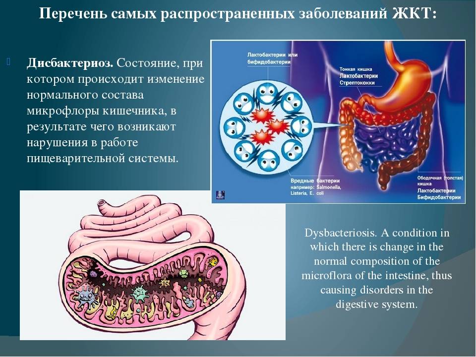 Заболевания желудка человека. Заболевания пищеварительного тракта. Заболевания органов ЖКТ.