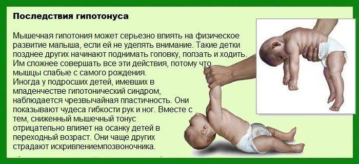 Детский массаж и гимнастика при мышечной дистонии у грудничка, причины синдрома у новорожденных