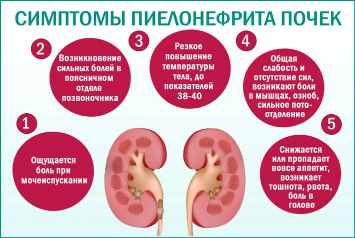 Пиелонефрит у ребёнка: с чего начинается, этапы оказания помощи | онлайн-доктор для всей семьи | prof-medstail.ru