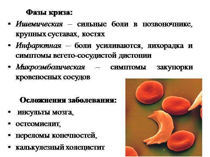 Диагностика и лечение серповидноклеточной анемии