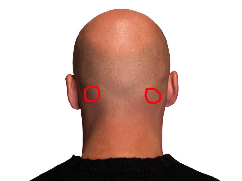 Подкожное уплотнение на шее, фото, причины слева или справа