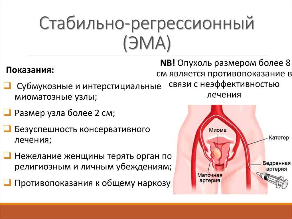 Эмболизация маточных артерий при миоме матки (эма): отзывы пациентов и противопоказания к проведению процедуры , отзывы, стоимость