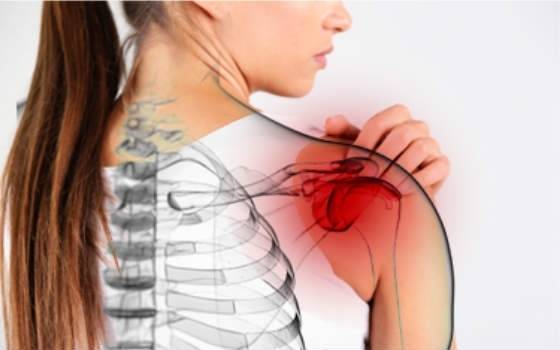 Периартрит плечевого сустава: симптомы и лечение