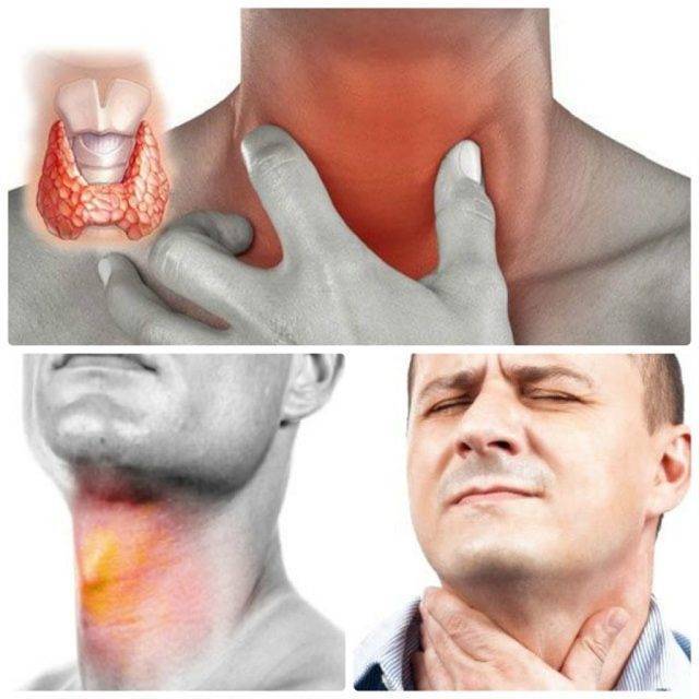 Першение в горле и сухой кашель: лечение народными средствами
