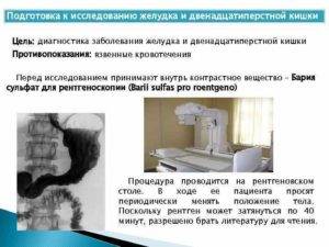 Рентгеноскопия желудка с барием