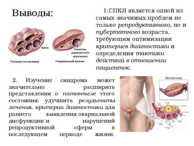 Дисфункция яичников | симптомы | диагностика | лечение - docdoc.ru