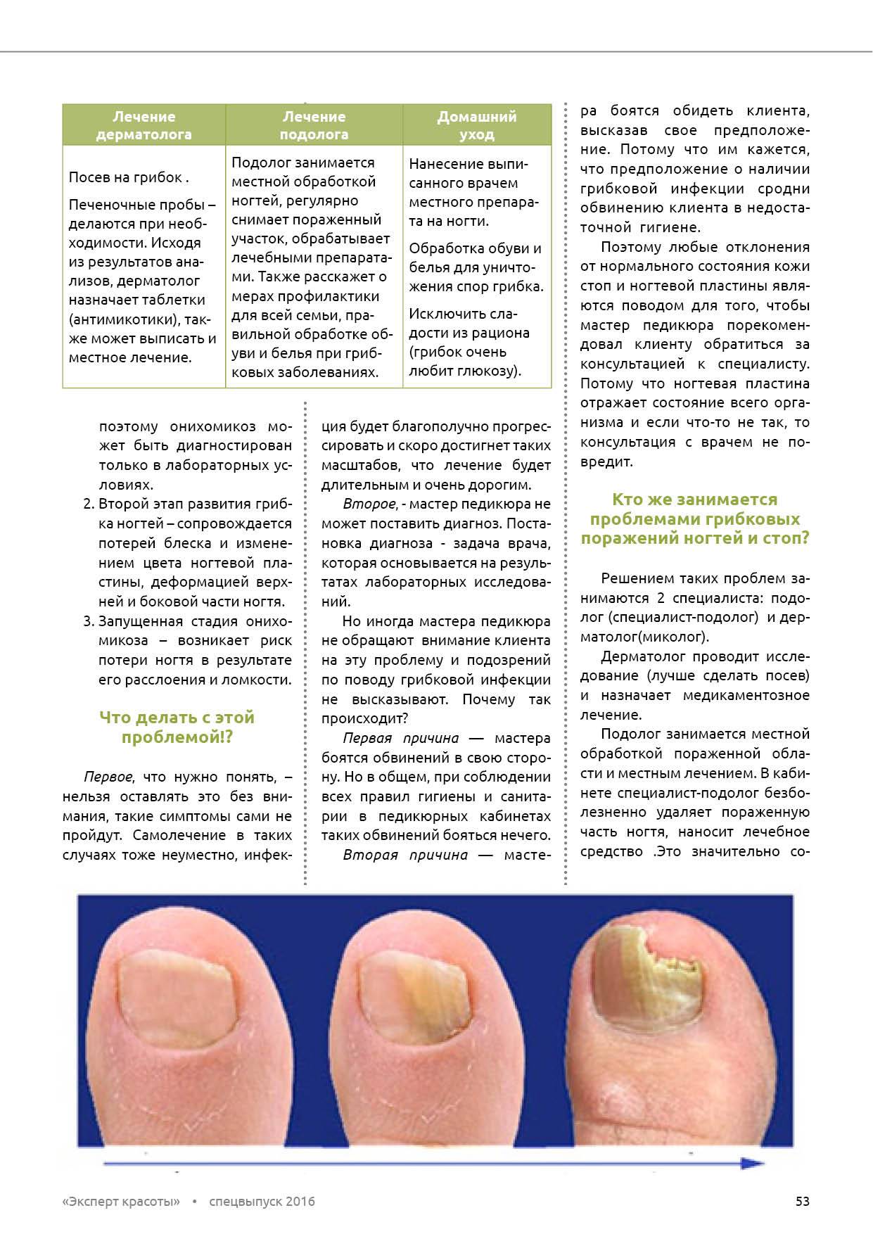 Лечение грибка ногтя врач