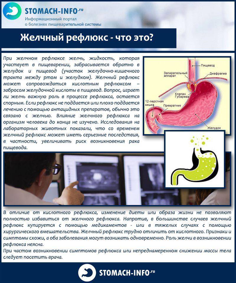 Что такое рефлюкс-эзофагит у взрослых: причины, симптомы, лечение