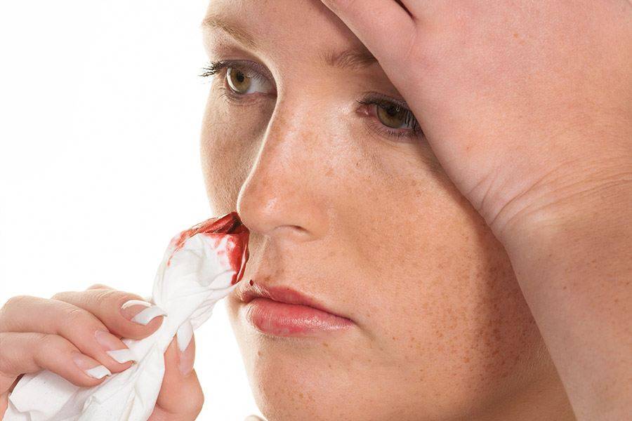 Кровь из носа у ребенка: причины, первая помощь, диагностика и лечение