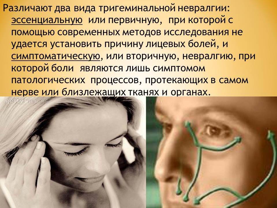 Эффективные советы по лечению лицевого нерва (неврита) дома