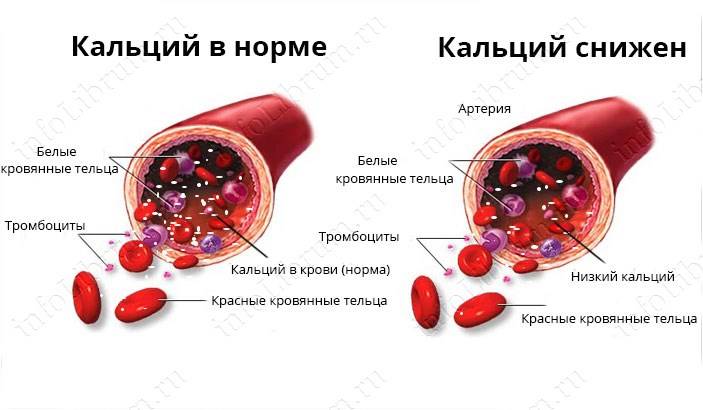 Норма кальция в крови у женщин,мужчин и детей по возрасту