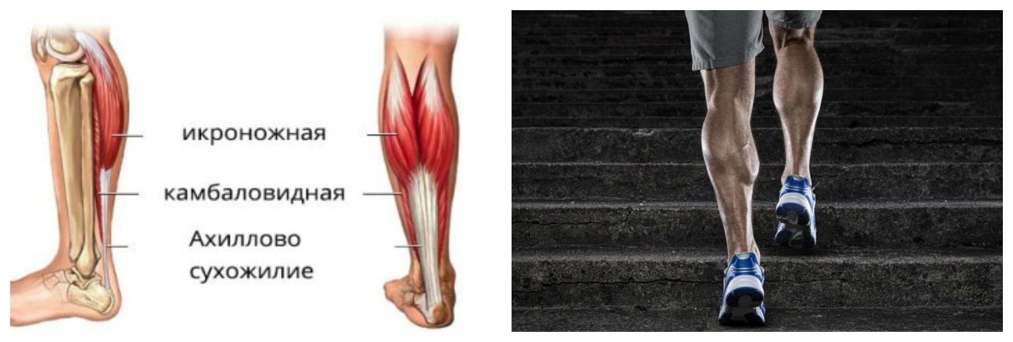 Растяжение мышц на ноге (икроножной и др): лечение и симптомы