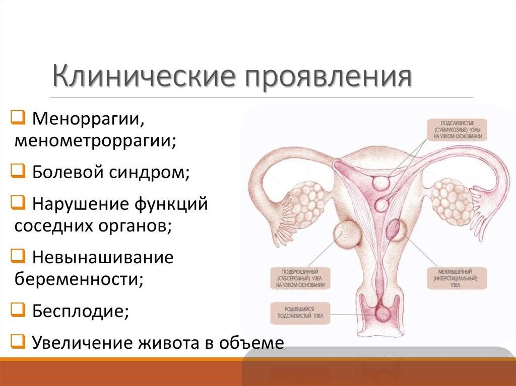 Как лечить эндометриоз матки народными средствами отзывы во время климакса