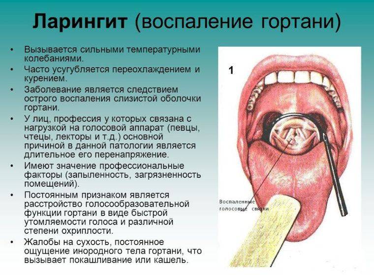 Першит в горле и сухой кашель: лечение. препараты и народные средства