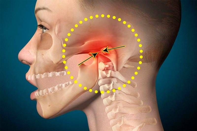 Сводит челюсть - причины тризма жевательной мускулатуры. болезнь или временное нарушение