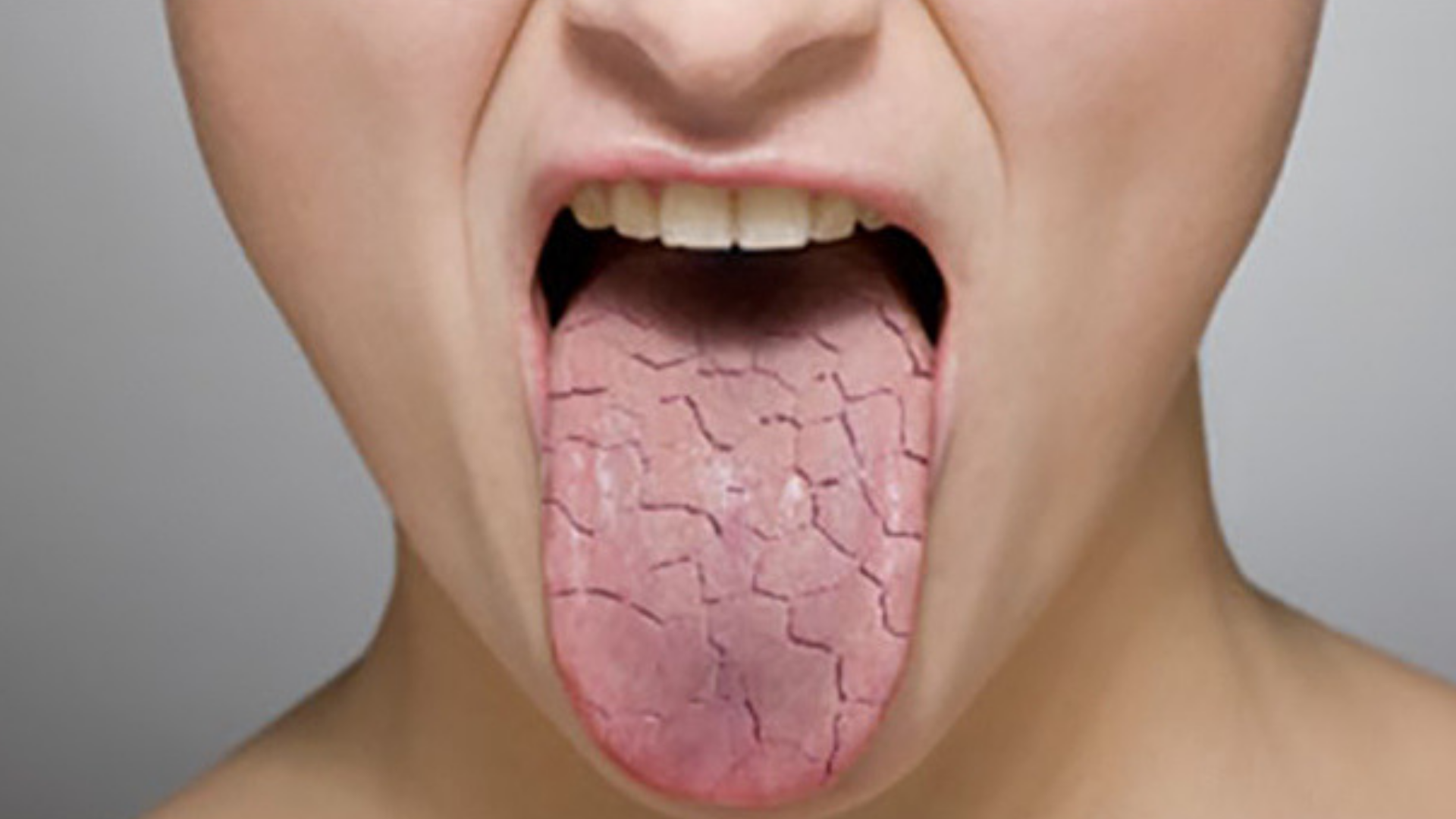 Привкус железа во рту: все причины