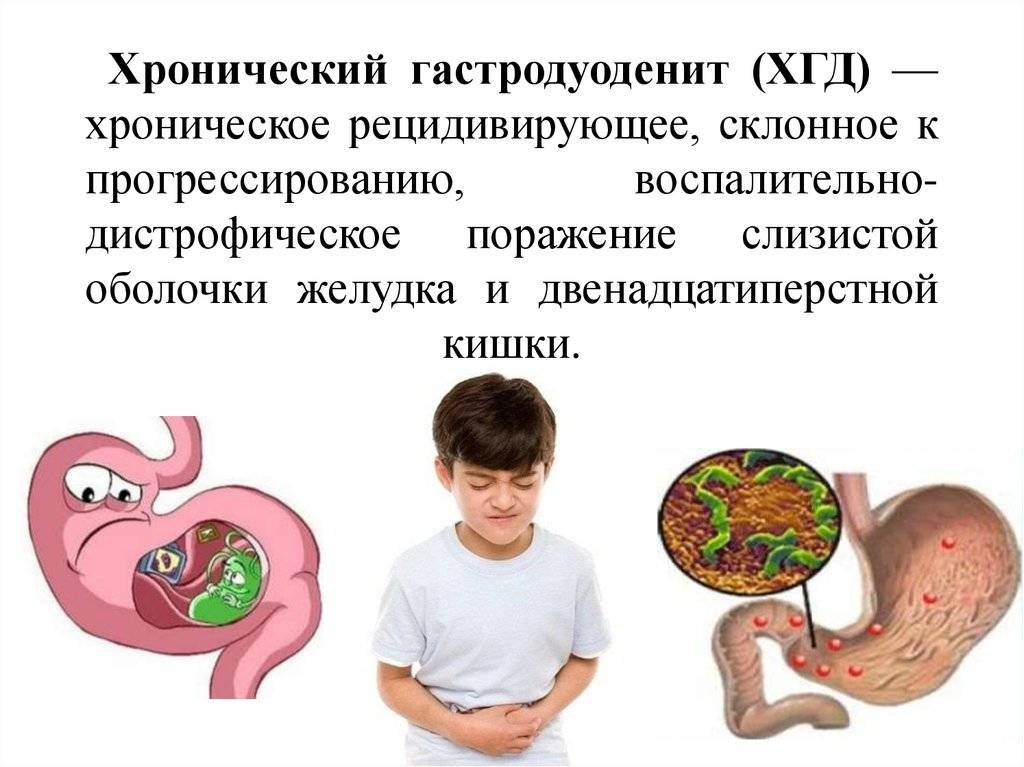 Симптомы эрозивного гастрита у ребенка