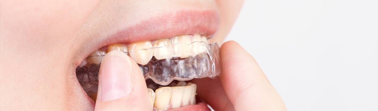 Что делать, если появился запах изо рта после удаления зуба?