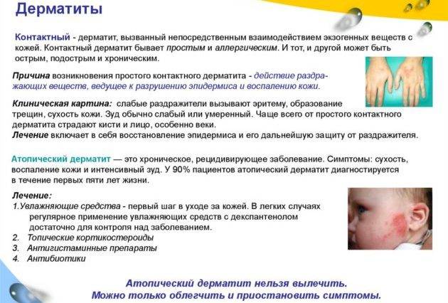 Как лечить у ребенка пеленочный дерматит: способы и фото
