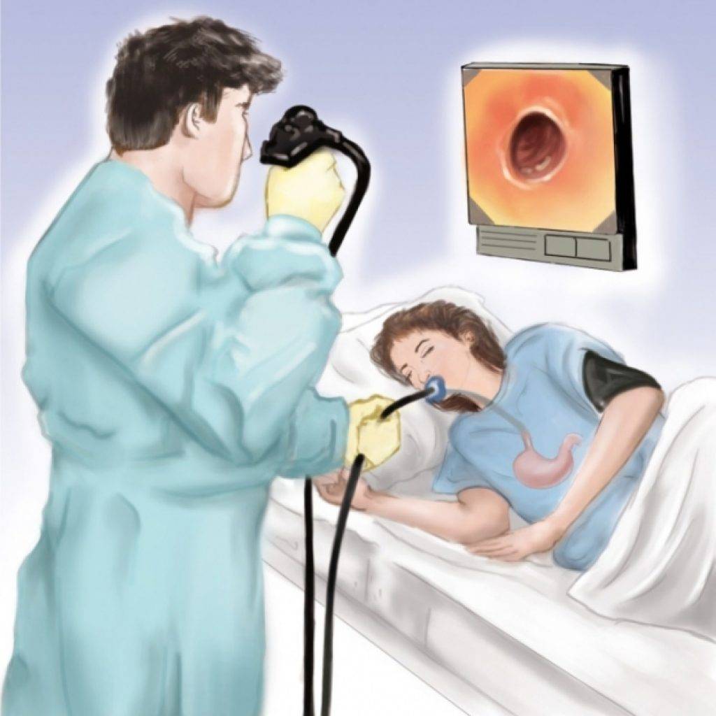 Гастроскопия желудка. как подготовиться к гастроскопии желудка?