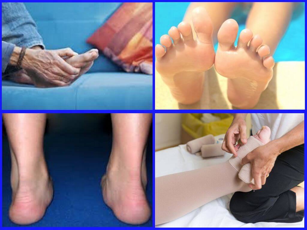 Болят ступни ног по утрам при наступании лечение народными средствами | spinahelp.ru