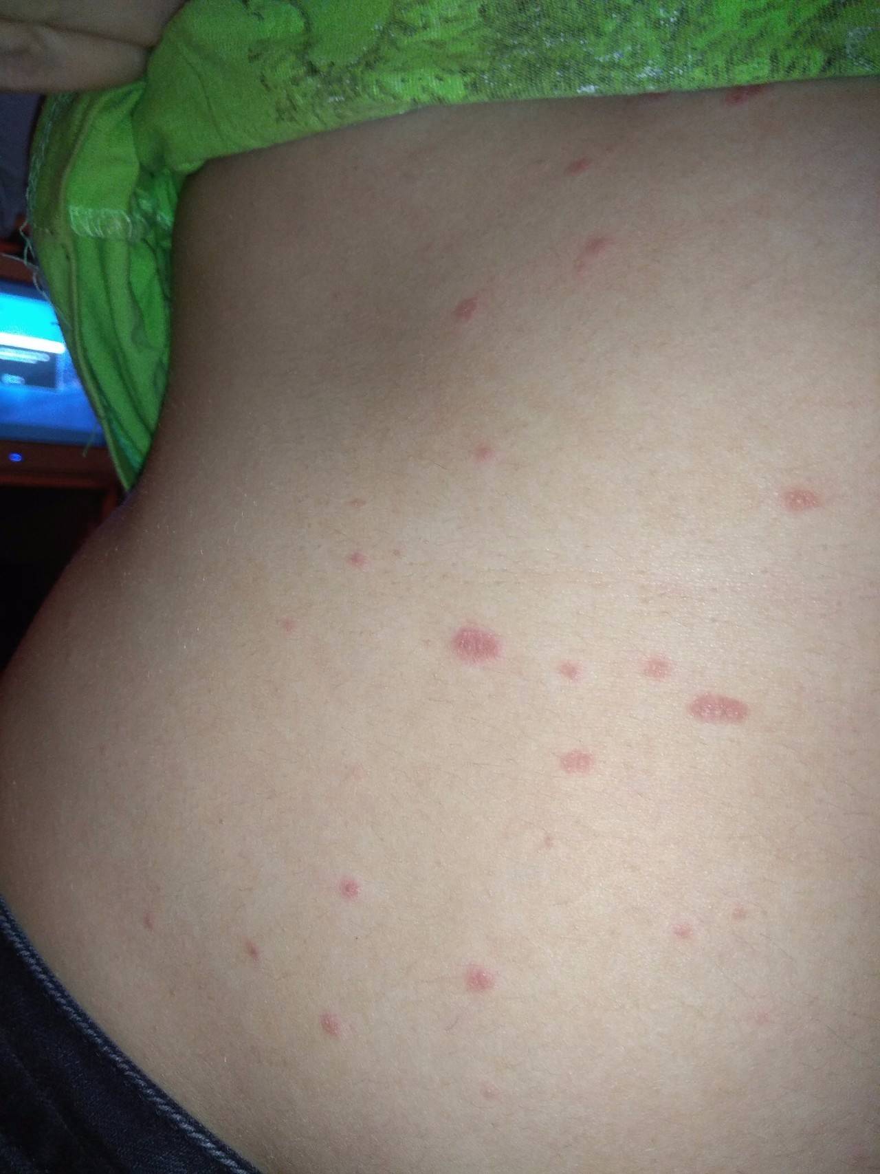 Аллергия на коже, красные пятна чешутся: фото, причины и лечение