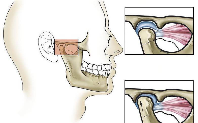 Боль при открывании рта в челюсти возле уха с левой и правой стороны: причины