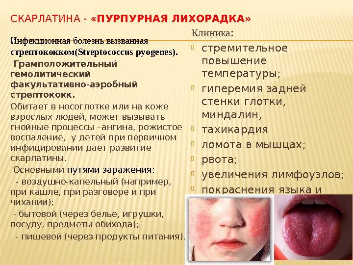 Скарлатина у детей (17 фото): симптомы и лечение, признаки, начальная стадия, что это, инкубационный период