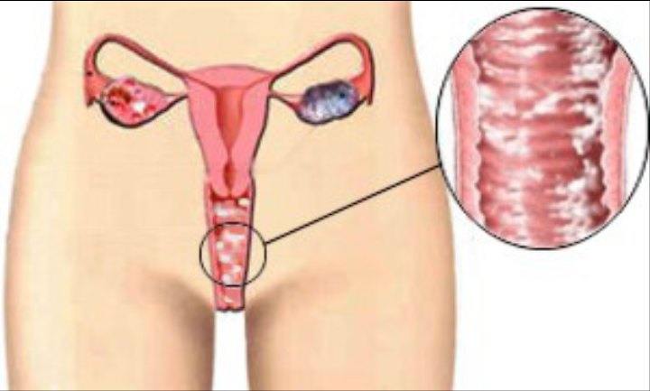Женские болезни: гинекология, зуд