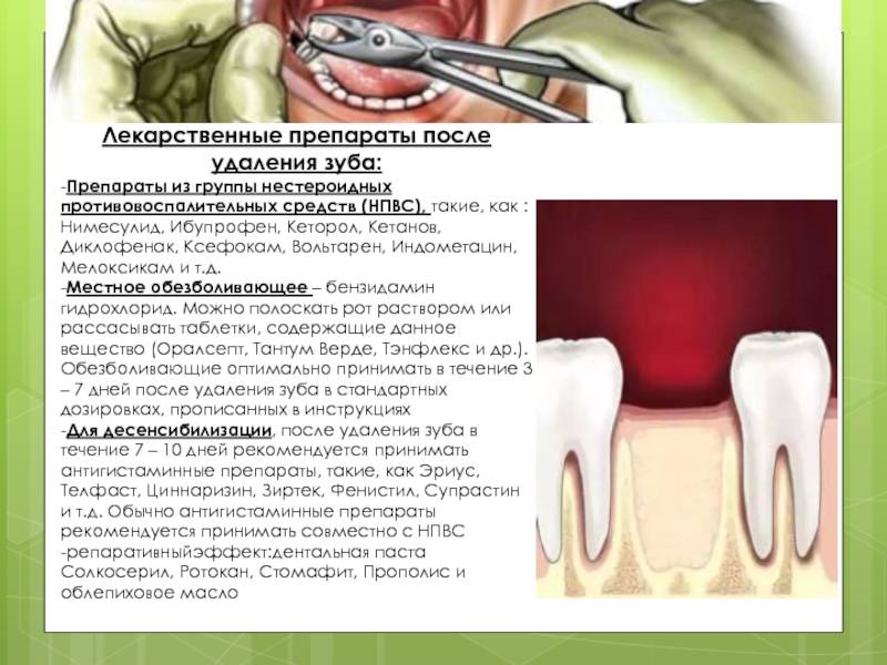 После удаления зуба изо рта пахнет гнилью - журнал стоматолога